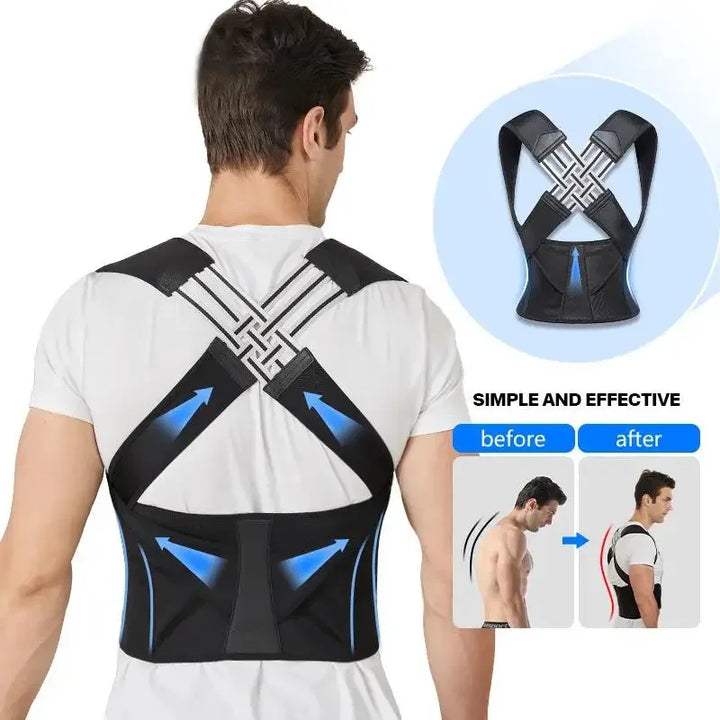 Posture Corrector – Back Support Belt